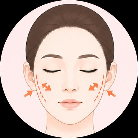 Malar Reduction Surgery