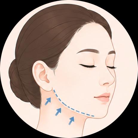 Mandibular Angle Reduction