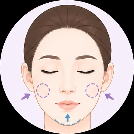 Genioplasty and Fat Graft on Cheek