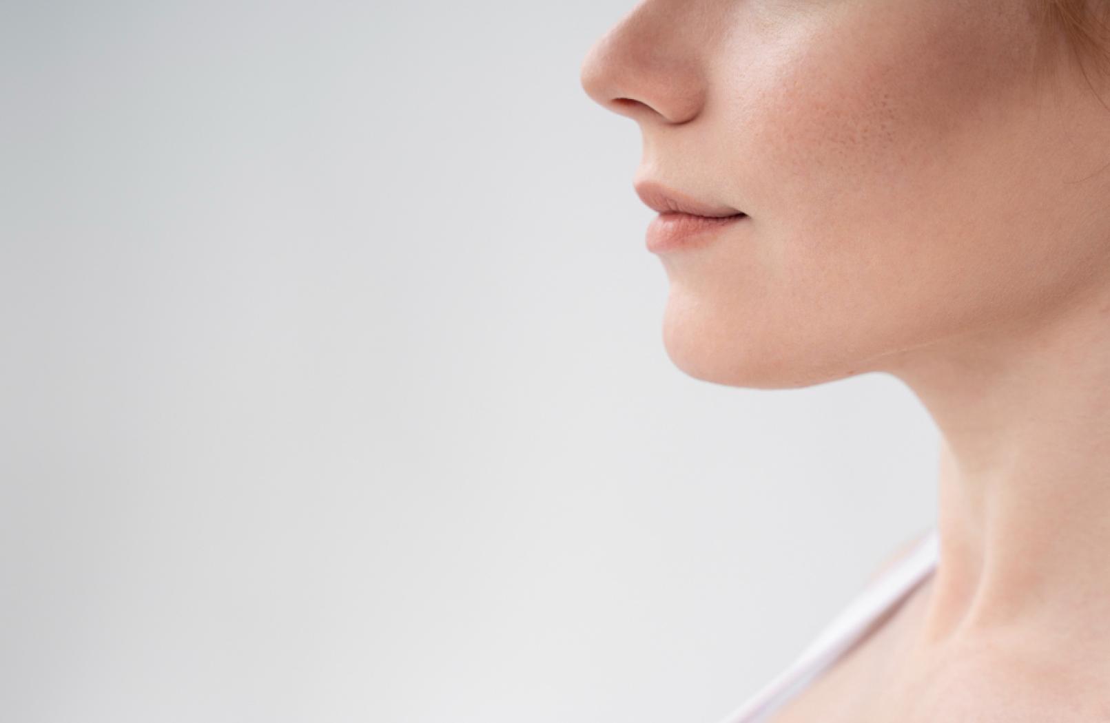Rhinoplasty