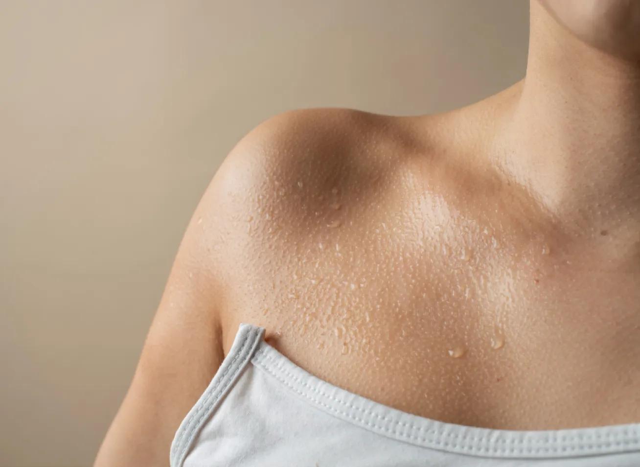Mejora de la hiperhidrosis y elasticidad de la piel (Dermotoxina).