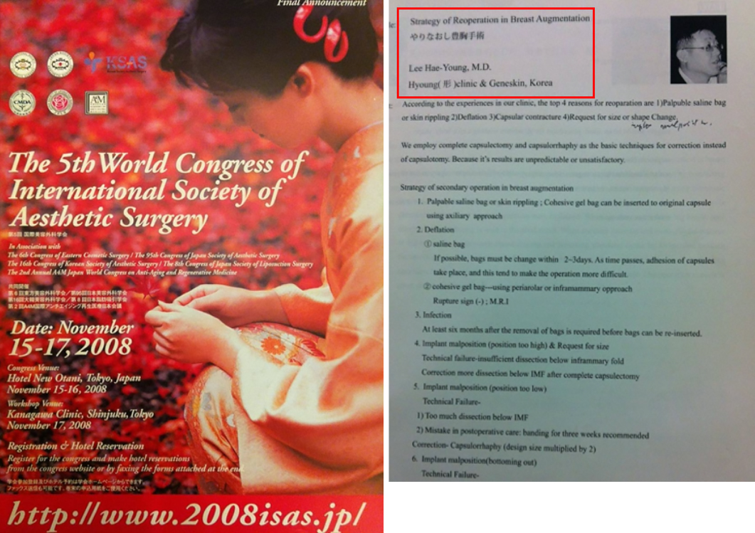 World Congress of International Society of Aesthetic Surgery 2008