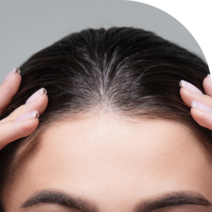 Hair Implant & Removal